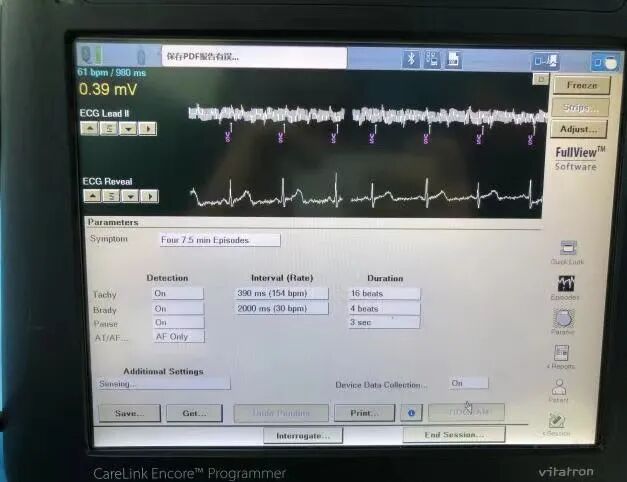 百多力起搏器怎么样迎新春丨我院心脏起搏器程控门诊全面升级_https://www.jmylbn.com_新闻资讯_第16张