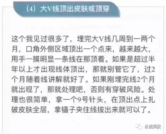 国械注进怎么查美思科蛋白线《国械注进》型号，规格，术后注意事项及详解_https://www.jmylbn.com_新闻资讯_第16张