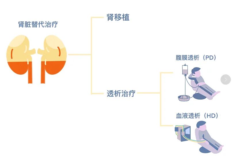 俞雨生教授 腹膜透析是肾脏替代一体化治疗的排头兵 肾脏关爱网