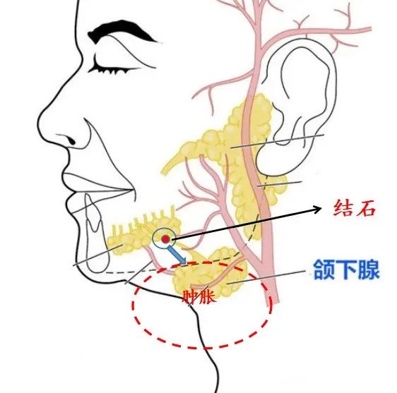 颈部唾液腺位置图片