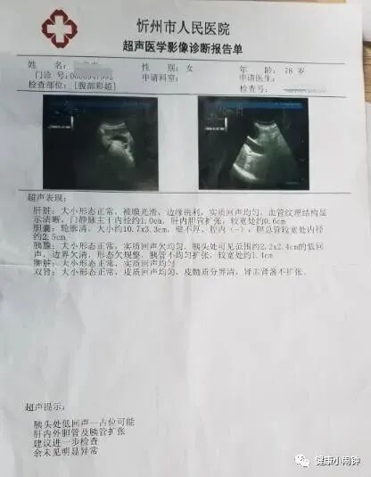 提醒大家！“癌王”胰腺癌，一发现即晚期！医生：4个症状不是胃病，要重视