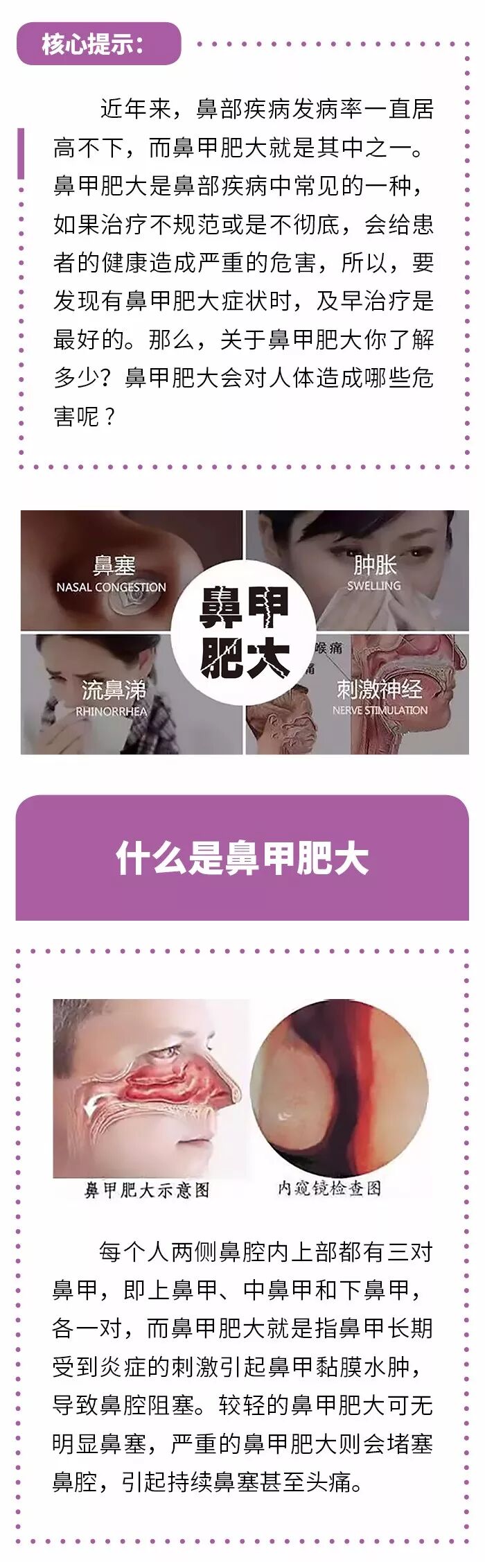 有一种颜值“杀手”，叫鼻甲肥大！