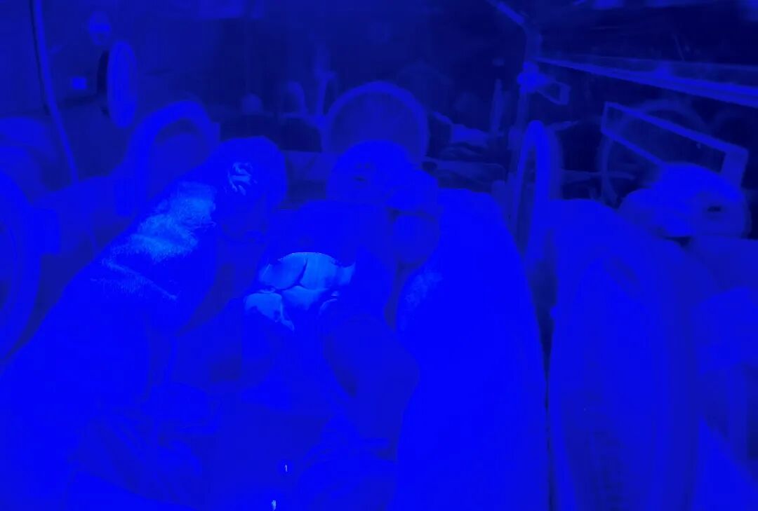 为什么要用光疗纸尿裤【贴心服务】我院儿科开展新生儿病理性黄疸日间光疗诊疗服务_https://www.jmylbn.com_新闻资讯_第2张