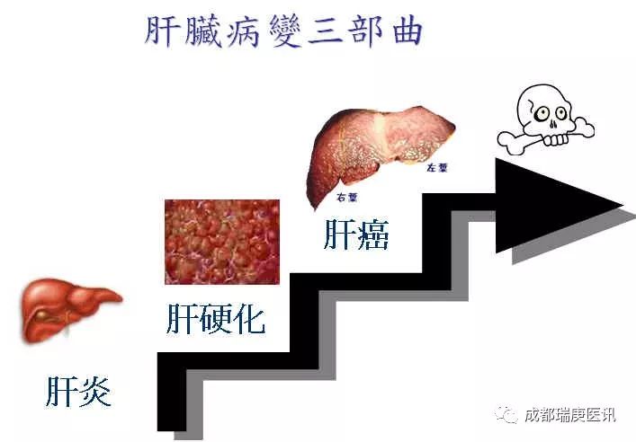 台湾长庚质子治 疗肝癌