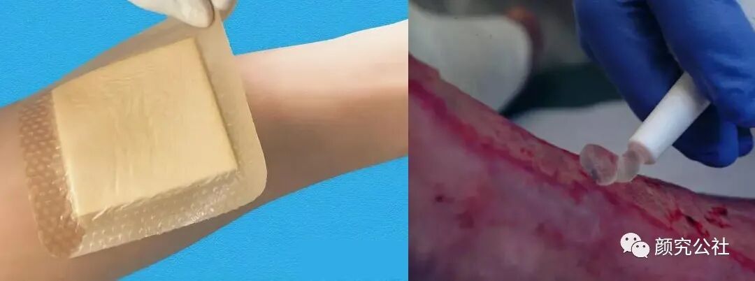人工敷料怎么照顾伤口伤口分类及护理原则（五）：敷料的选择和选分类_https://www.jmylbn.com_新闻资讯_第12张