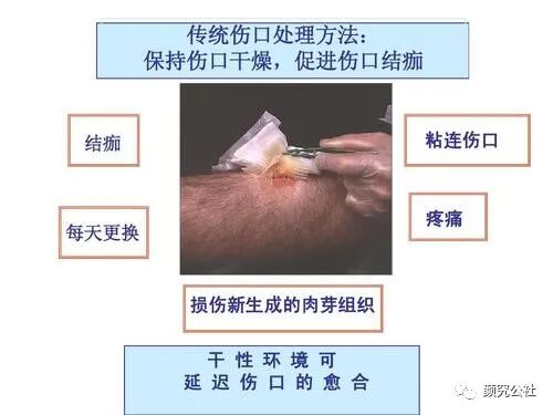 液体伤口敷料怎么用伤口护理‖新型液体敷料使治疗高效和简单化_https://www.jmylbn.com_新闻资讯_第3张