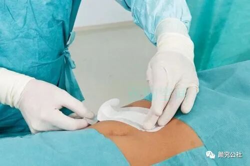 液体伤口敷料怎么用伤口护理‖新型液体敷料使治疗高效和简单化_https://www.jmylbn.com_新闻资讯_第2张