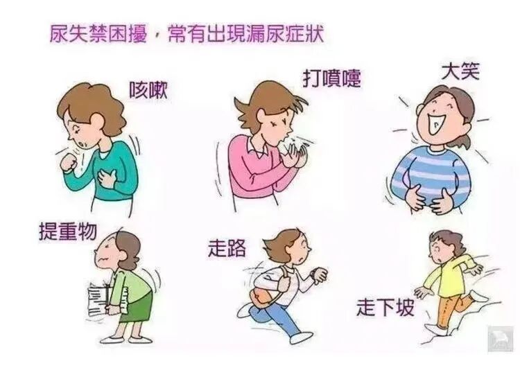 尿道张力过强怎么回事我院泌尿外科自主完成我院首例女性压力性尿失禁经闭孔无张力尿道中段悬吊术_https://www.jmylbn.com_新闻资讯_第8张