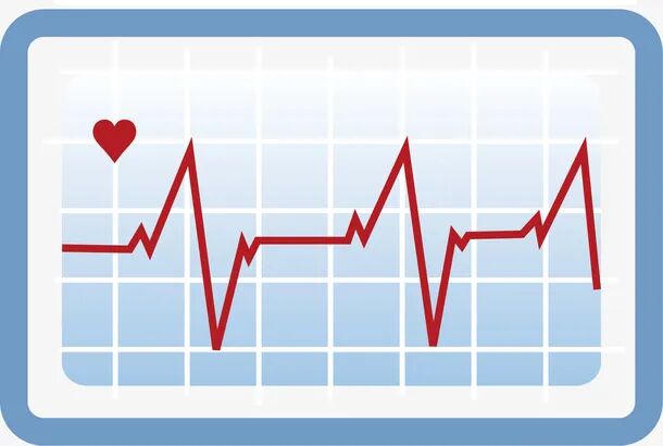 动态心电图怎么分析动态心电图，24小时守护您的“心”健康！_https://www.jmylbn.com_新闻资讯_第5张