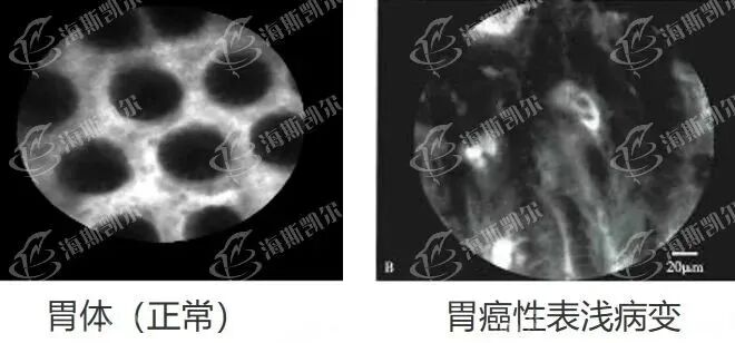 clearvue是什么独墅SHOW ｜  光学诊断新势力，攻破顶尖“扫癌利器”_https://www.jmylbn.com_新闻资讯_第6张