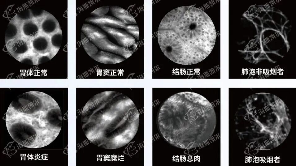 clearvue是什么独墅SHOW ｜  光学诊断新势力，攻破顶尖“扫癌利器”_https://www.jmylbn.com_新闻资讯_第5张