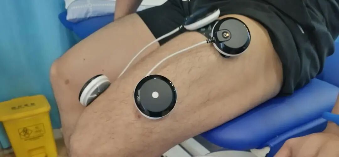 中频为什么能镇痛神经肌肉电刺激——肩颈腰腿痛患者的福音_https://www.jmylbn.com_新闻资讯_第6张