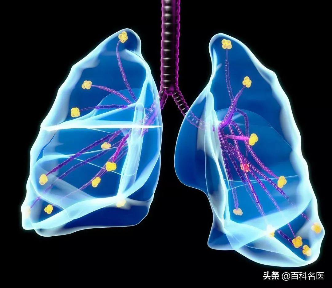 遇上老慢支，这个冬天怎么过？专家支招，有效治疗慢性支气管炎