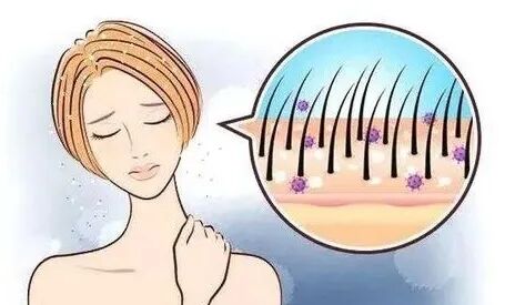 有这些症状，当心患上毛囊炎！