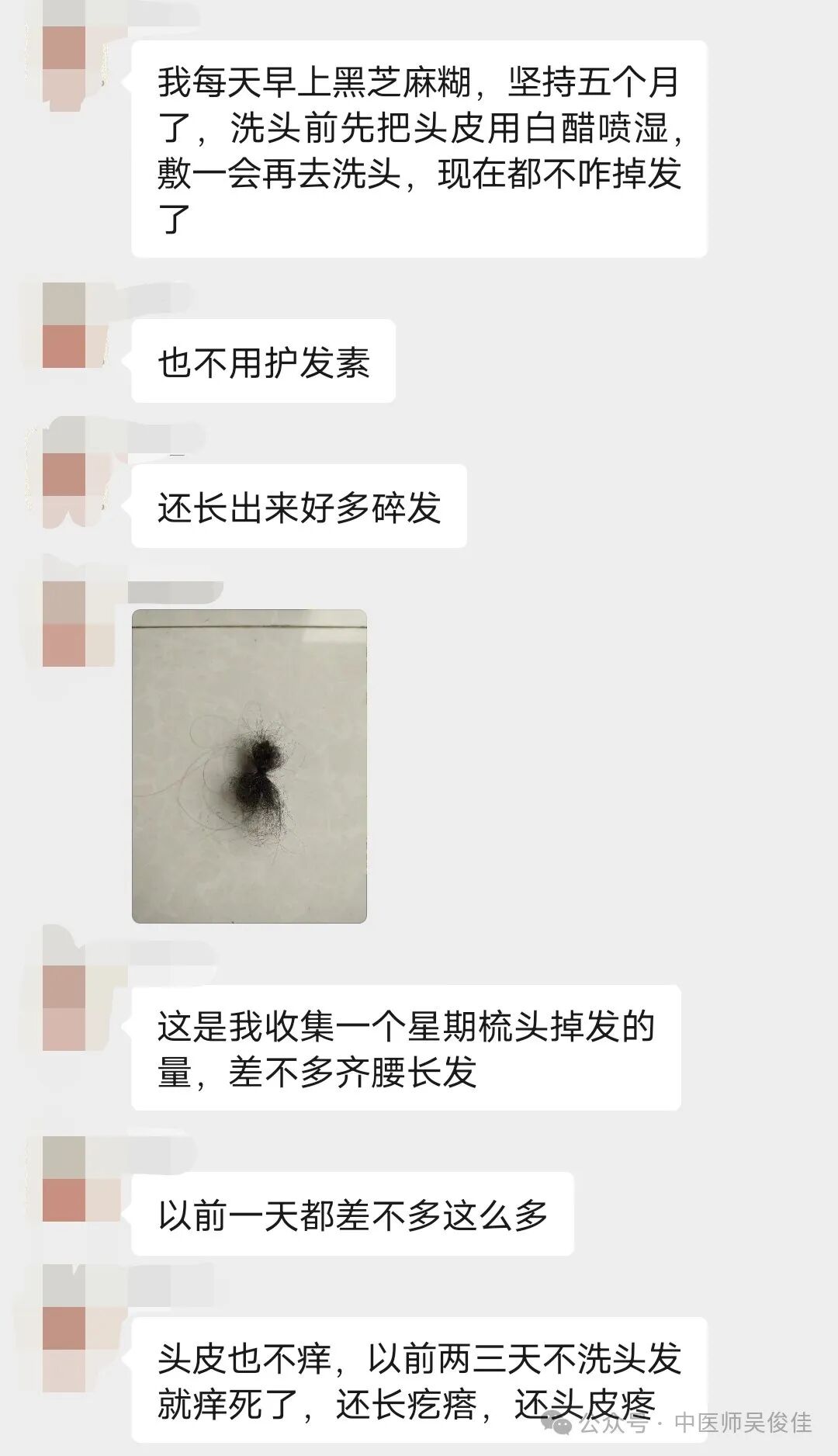 掉头发严重，用这两个办法就可以搞定哦｜养生妙招