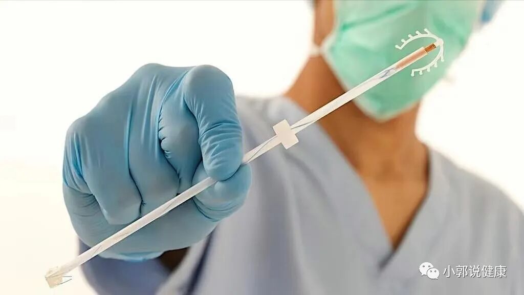 取环要用什么器械女性上环的全过程，胆小者勿进，男女都要好好看看，珍惜眼前人！-上海聚慕医疗器械有限公司