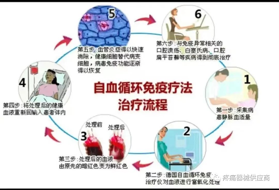 什么是臭氧大自血疗法臭氧大自血疗法是什么？_https://www.jmylbn.com_新闻资讯_第3张