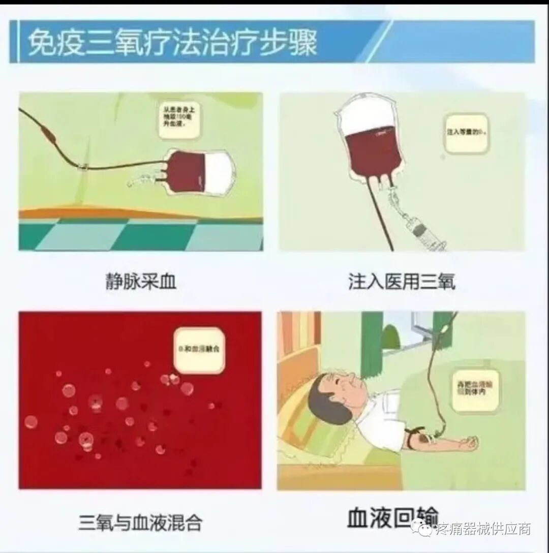 什么是臭氧大自血疗法臭氧大自血疗法是什么？_https://www.jmylbn.com_新闻资讯_第2张