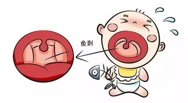 【涨知识】鱼刺卡喉,喝醋,吞饭哪个最有用. - 花盈路香的主页