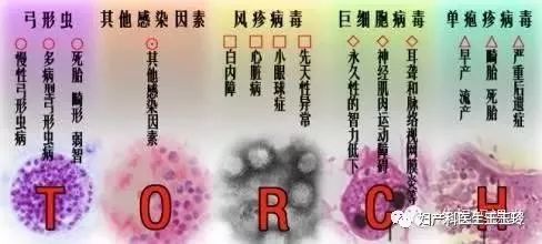 TORCH檢查，你查了嗎？ 健康 第1張