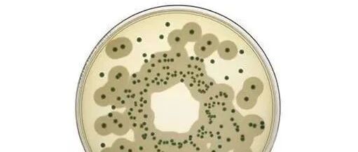 预防李斯特菌，孕期千万不要吃这三类食物