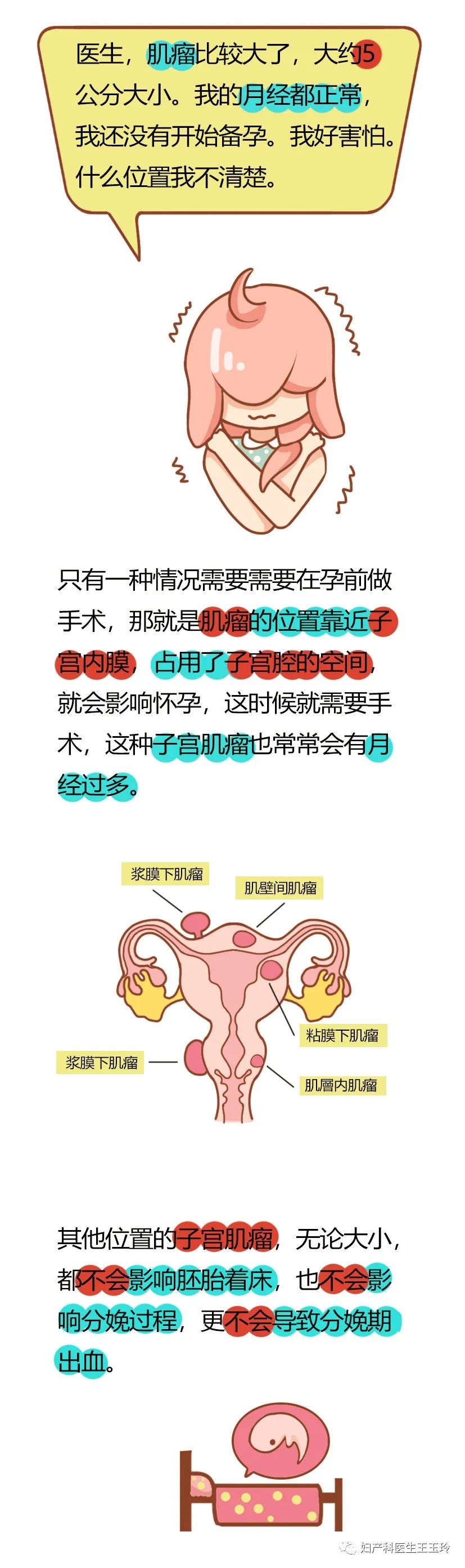 懷孕前要切子宮肌瘤嗎？ 親子 第3張