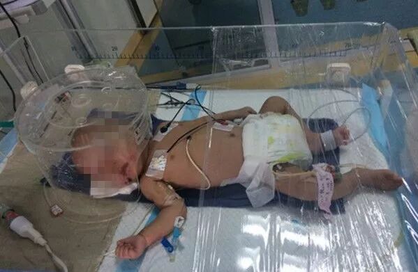 江阴受伤男婴被虐一案宣判 撤销监护人资格