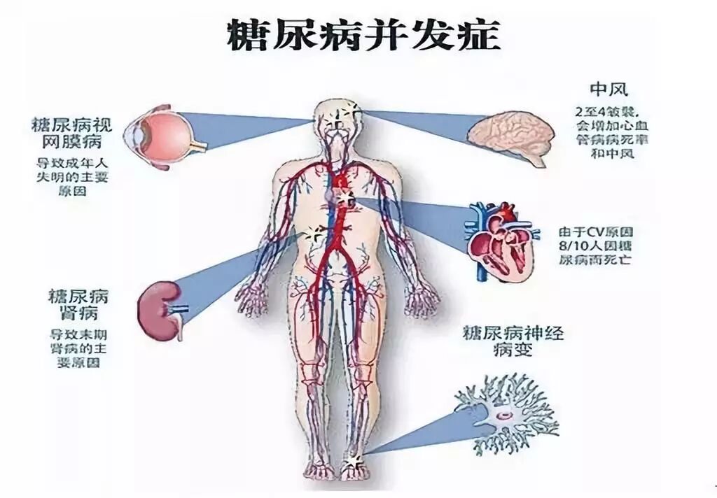 SOD与健康 |SOD对糖尿病的作用