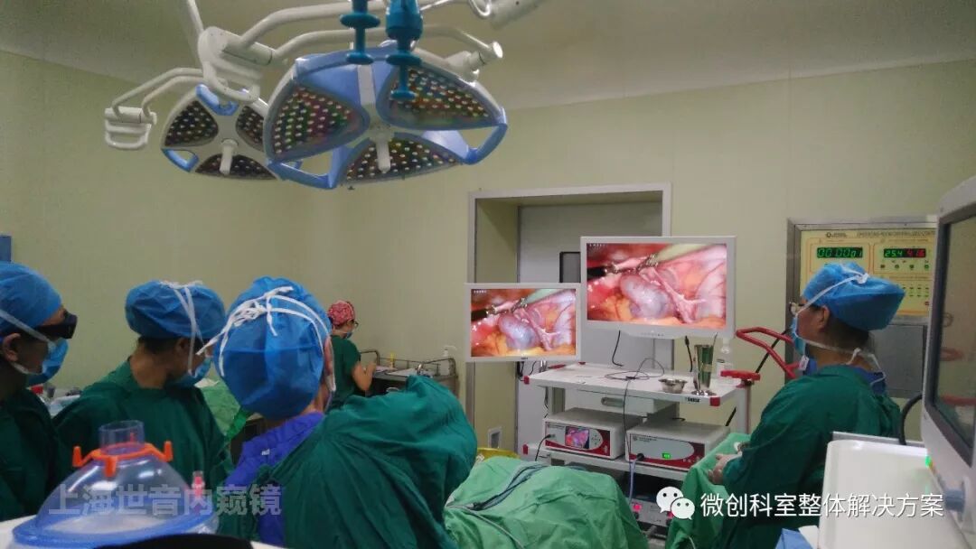 妇科电凝是什么【妇科腹腔镜篇】卵巢囊肿剥除术-上海聚慕医疗器械有限公司