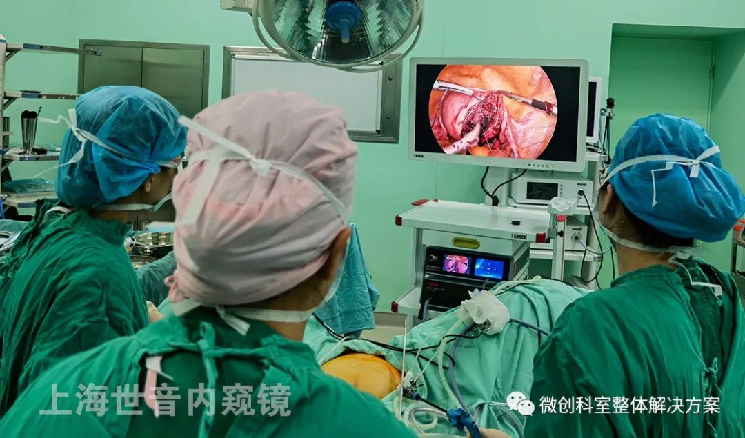 【婦科腹腔鏡篇】子宮肌瘤剝除術 - 新聞動態 - 上海世音光電儀器有限