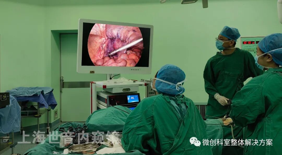 疝气补片怎么固定【4K腹腔镜篇】疝气修补手术_https://www.jmylbn.com_新闻资讯_第3张