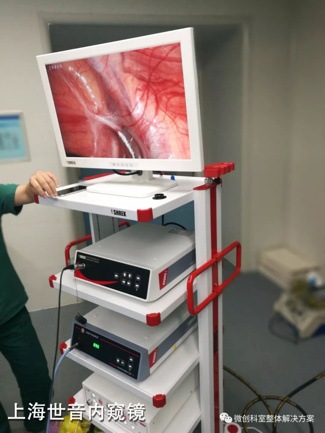 疝气补片怎么固定【腹腔镜篇】疝修补术——疝气的最佳手术方式_https://www.jmylbn.com_新闻资讯_第10张