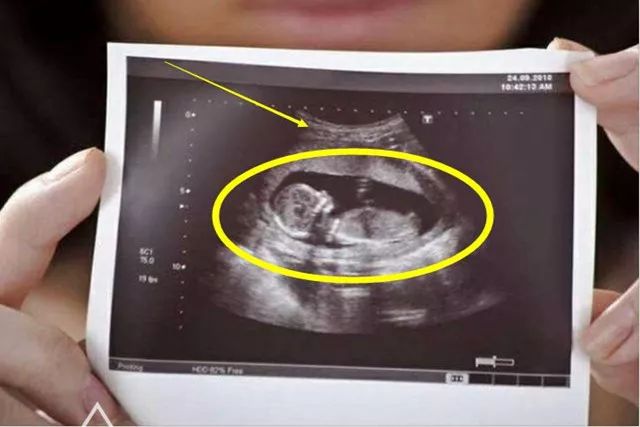 4个的原因男翻女_为什么说男翻女几率大_男翻女可能性