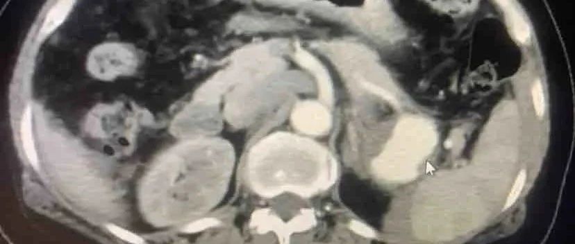 cover_image
