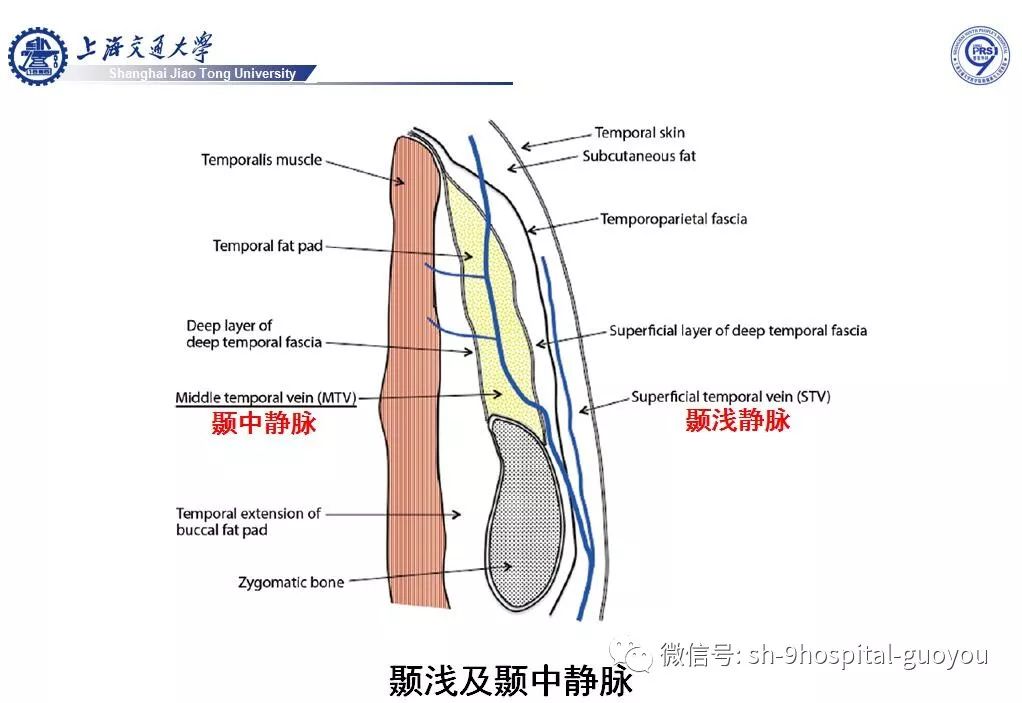 经典皮瓣系列之二 颞 顶 筋膜瓣临床应用解剖 九院张国佑 微信公众号文章阅读 Wemp