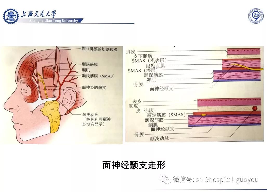 经典皮瓣系列之二 颞 顶 筋膜瓣临床应用解剖 九院张国佑 微信公众号文章阅读 Wemp