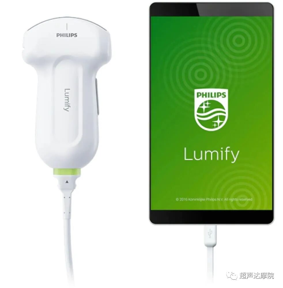 索诺星超声怎么样掌上超声新时代，来看看哪些是主流？_https://www.jmylbn.com_新闻资讯_第15张