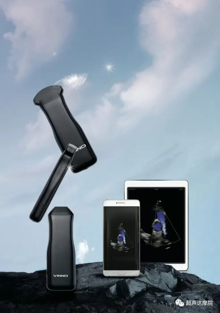 索诺星超声怎么样掌上超声新时代，来看看哪些是主流？_https://www.jmylbn.com_新闻资讯_第4张