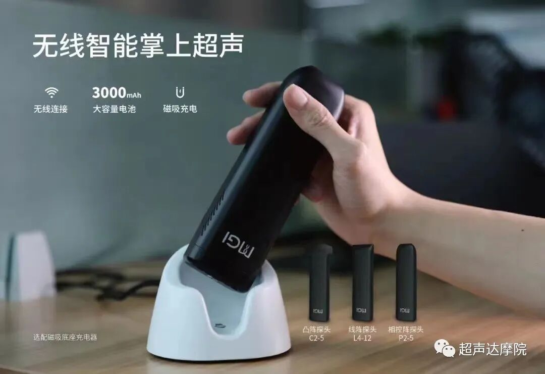 索诺星超声怎么样掌上超声新时代，来看看哪些是主流？_https://www.jmylbn.com_新闻资讯_第11张