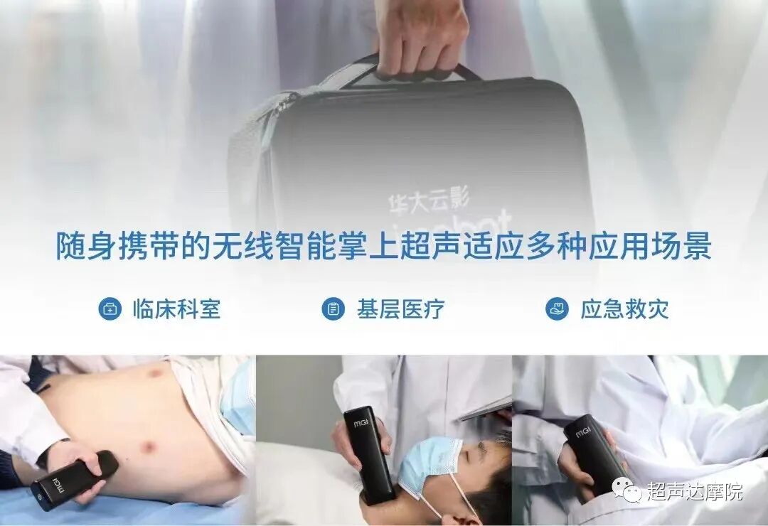 索诺星超声怎么样掌上超声新时代，来看看哪些是主流？_https://www.jmylbn.com_新闻资讯_第12张