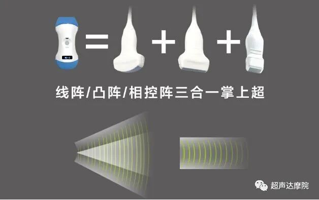 索诺星超声怎么样掌上超声新时代，来看看哪些是主流？_https://www.jmylbn.com_新闻资讯_第8张