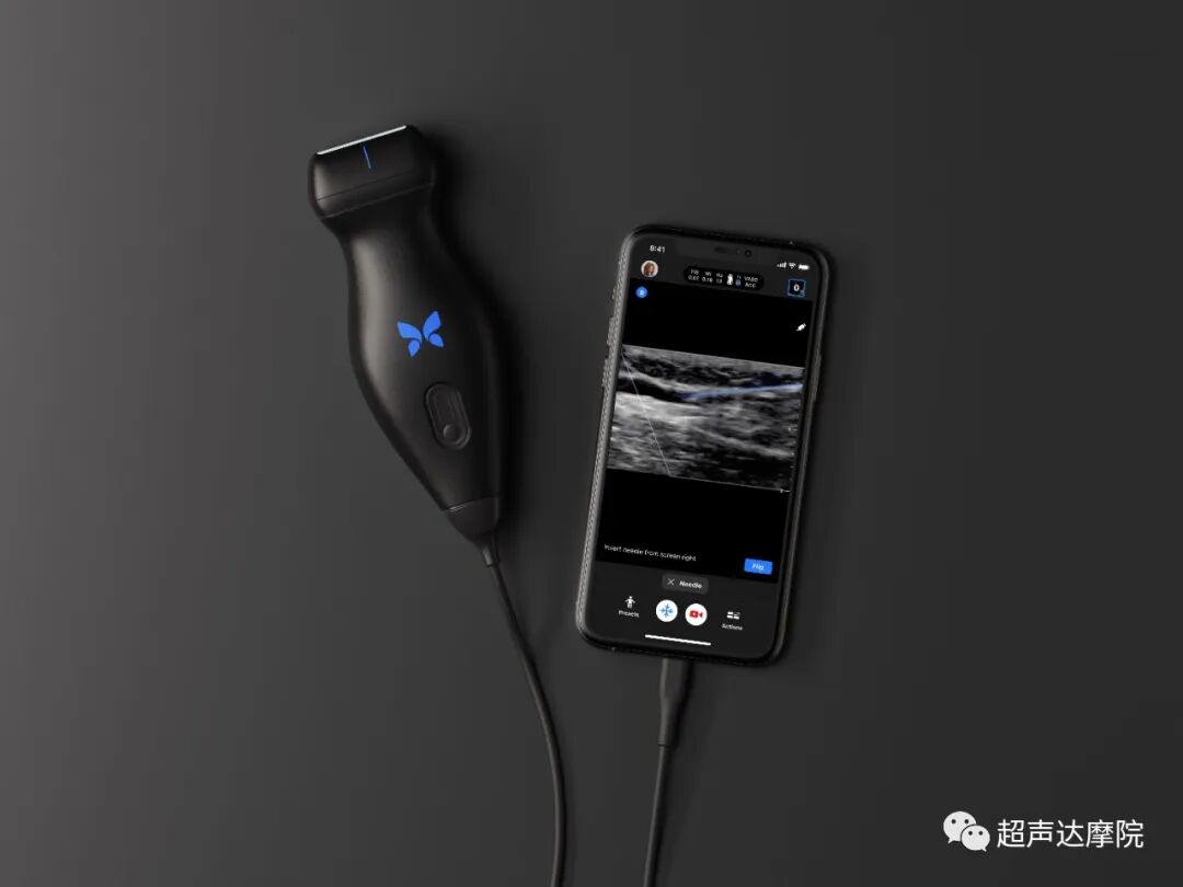 索诺星超声怎么样掌上超声新时代，来看看哪些是主流？_https://www.jmylbn.com_新闻资讯_第13张