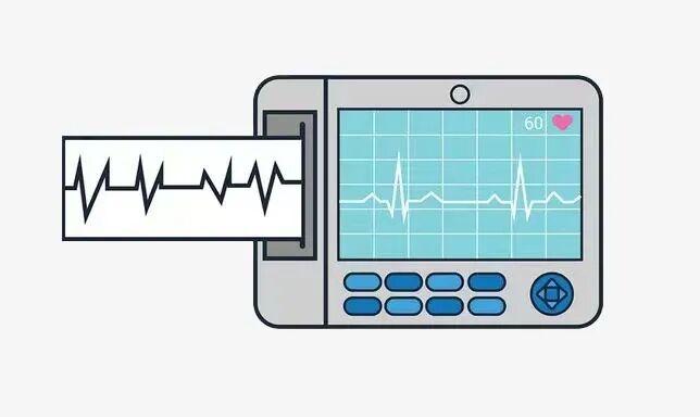 动态心电图仪器怎么看科学就医行动——动态心电图_https://www.jmylbn.com_新闻资讯_第14张