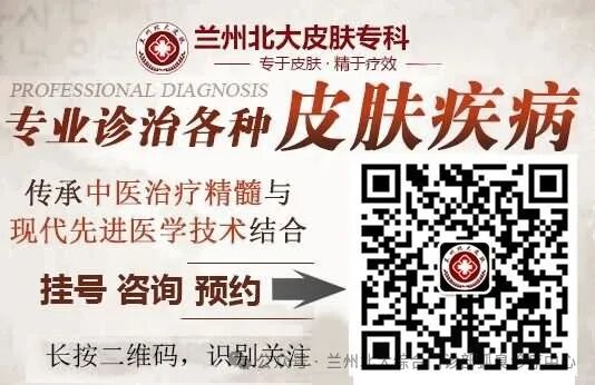 癣菌病：手足癣、股癣：兰州哪家医院皮肤科好-兰州北大皮肤科是正规医院吗