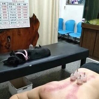 看到主人拔罐，狗子哭着要陪他，那就只好...一起拔！