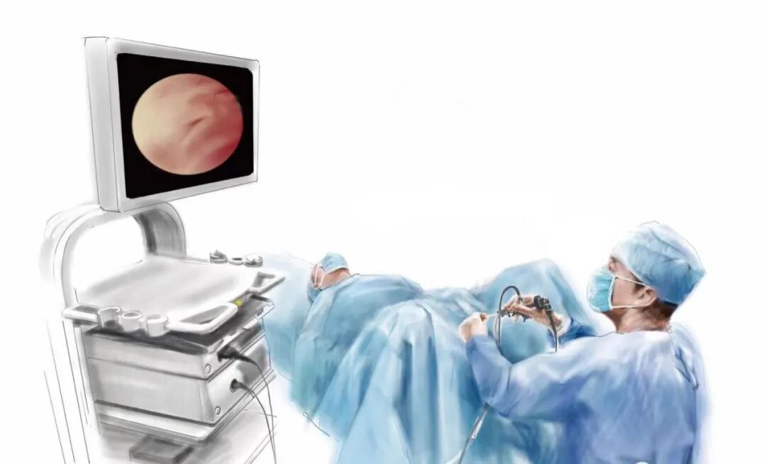 b膀胱镜为什么消毒患者福音！膀胱镜检查进入无痛新时代！_https://www.jmylbn.com_新闻资讯_第6张