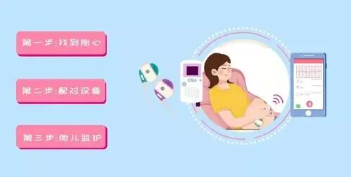 什么是胎儿监护胎心监护怎么看？什么情况下孕妈需要做胎心监护？_https://www.jmylbn.com_新闻资讯_第5张