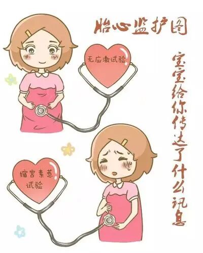 什么是胎儿监护胎心监护怎么看？什么情况下孕妈需要做胎心监护？_https://www.jmylbn.com_新闻资讯_第4张