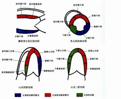 但对多支冠状动脉病的敏感性可达90%