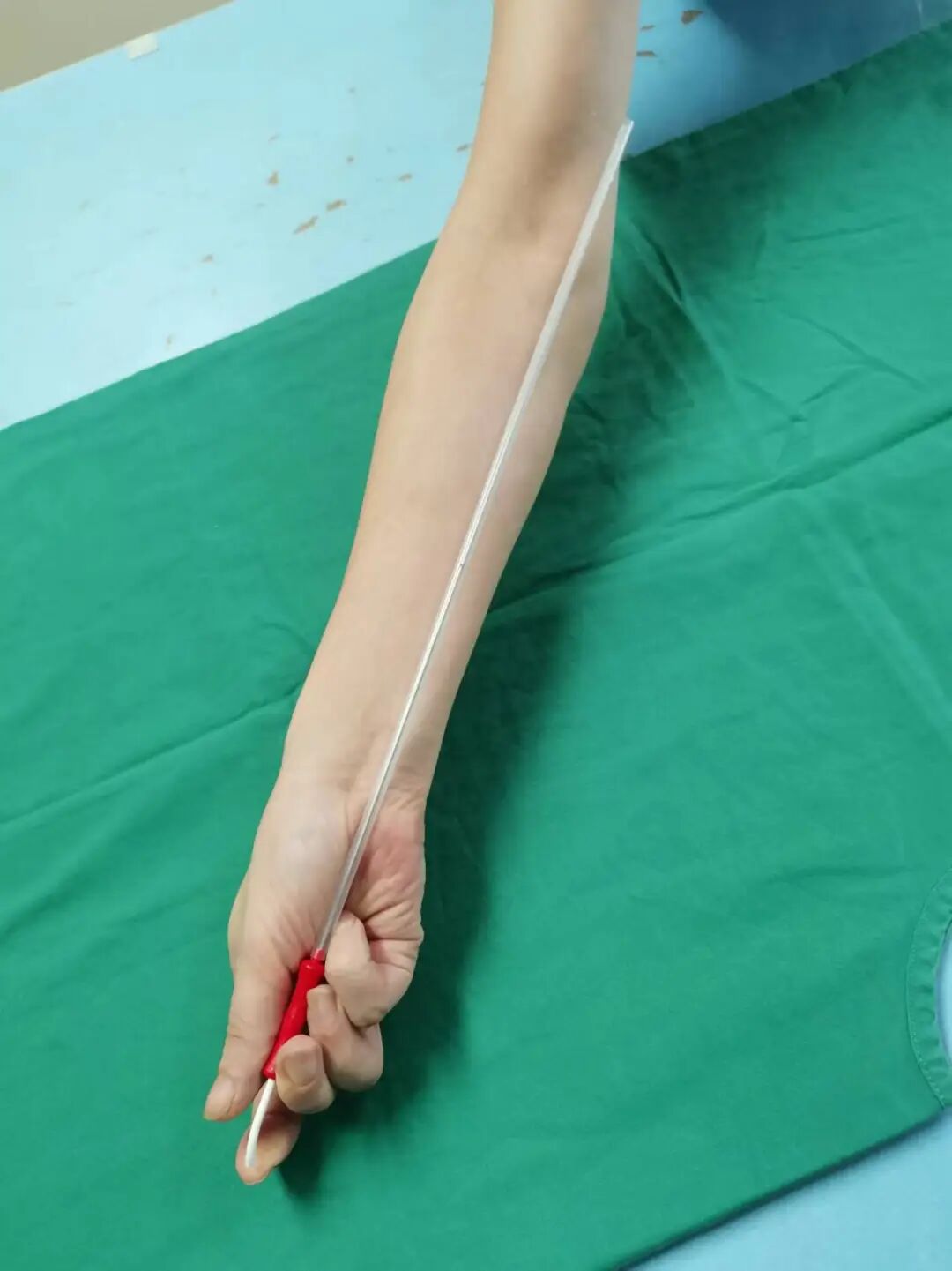 取卵针长什么样取卵针那么长，取卵手术真的无痛吗？_https://www.jmylbn.com_新闻资讯_第3张